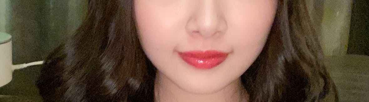 リエンジャン美容外科 江南本店で口角ボトックスを受けたもぐもぐさんの写真