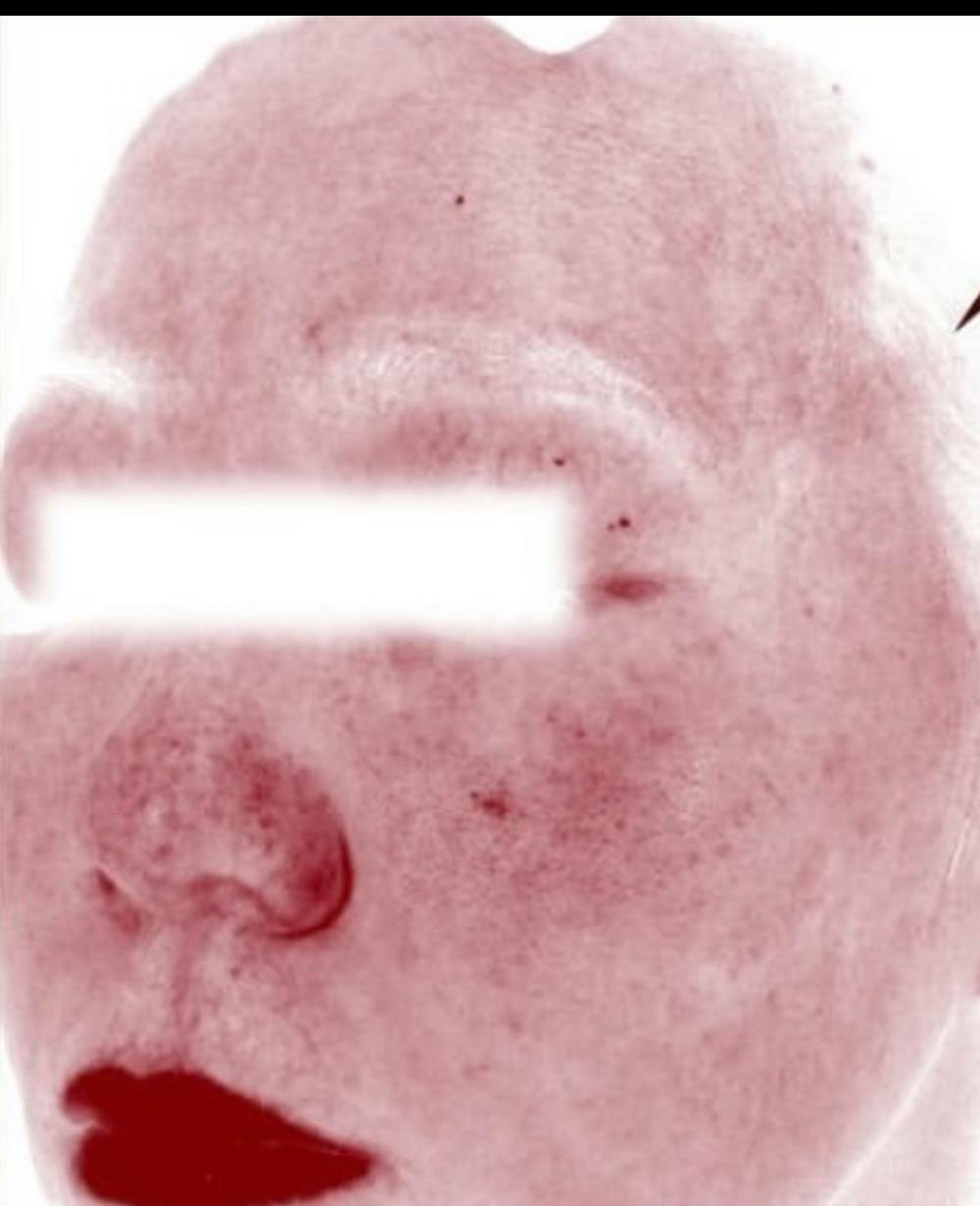 【女性・肌の赤み鎮静】メソナj_b1