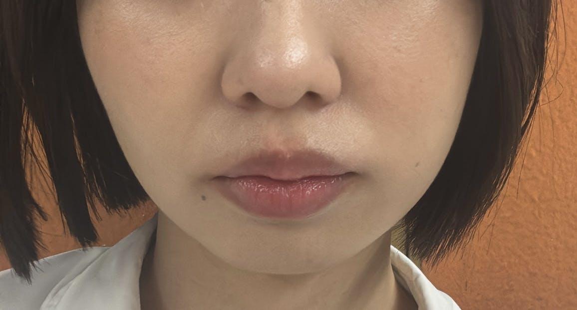 湘南美容クリニック 錦糸町院でエレクトロポレーション・イオン導入を受けたみなさんの写真