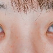 【女性・目元】クイックコスメティーク・シングルNeo、クイックコスメティーク・ダブルNeo_justbefore