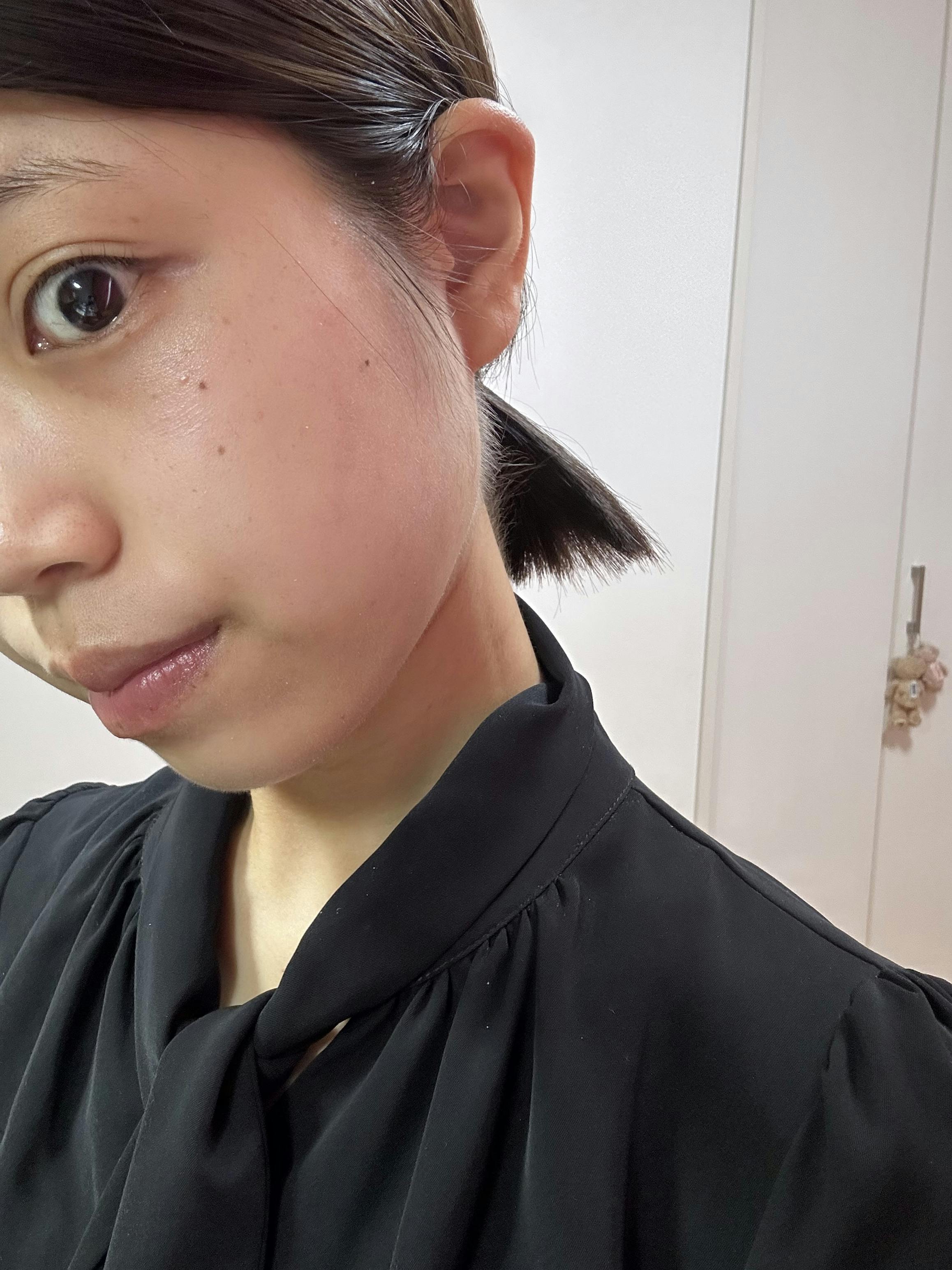 湘南美容クリニック 大阪心斎橋院_フォトダブル
