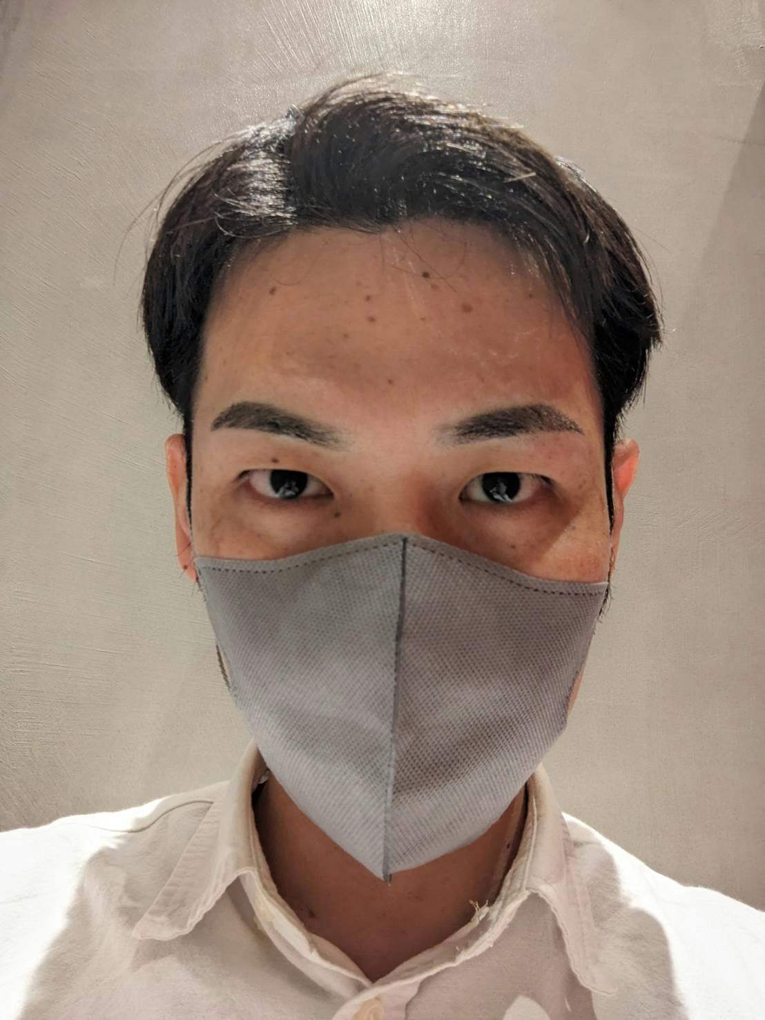 Dクリニック福岡でアートメイクを受けたやんぴんさんの写真