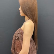 【女性・二の腕】Aquicell(アキーセル)脂肪吸引_aftar