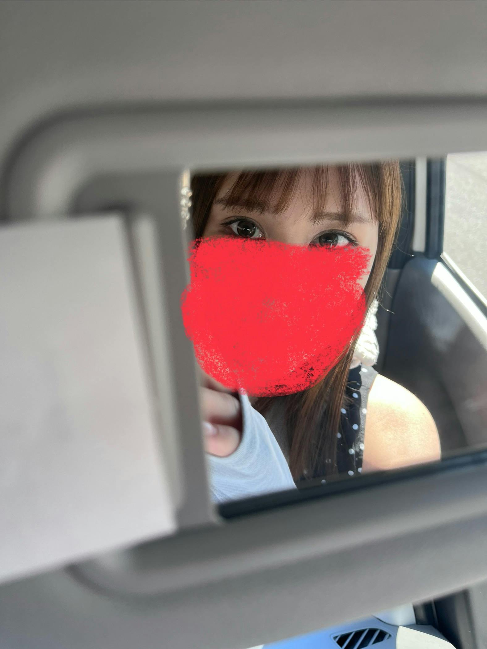 蘇春堂形成外科で眼瞼下垂手術を受けたelleriさんの写真