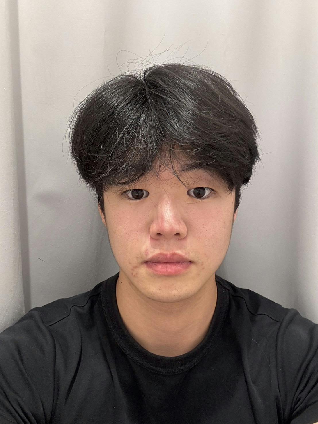 L’or Clinic Omotesando 表参道院（ロールクリニックオモテサンドウ）でを受けたkさんの写真