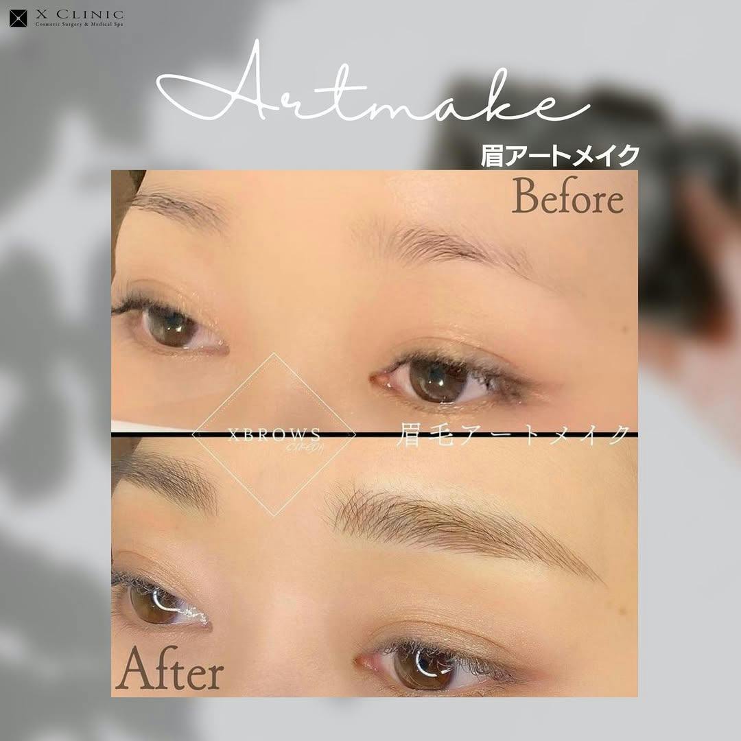【女性・眉】眉アートメイク_before_aftar