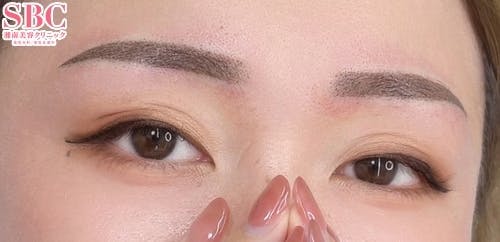 【女性・眉】アートメイク(眉毛)_after