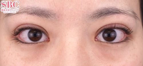 【20代女性・目元】クイックコスメティーク・トリプルNeo_0day