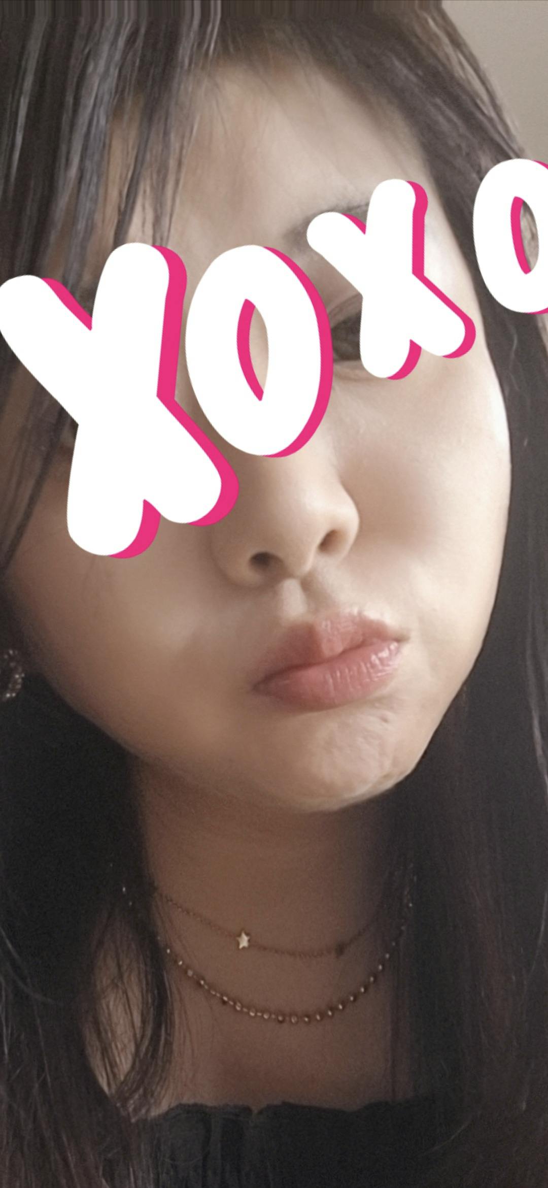 品川スキンクリニック岡山院でコラーゲンピールを受けたマチルダさんの写真