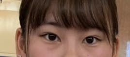 湘南美容クリニック 名古屋駅本院でクマ取りを受けたあいさんの写真