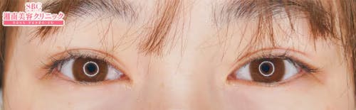 【女性・目元】クイックコスメティーク・ダブルNeo_1week