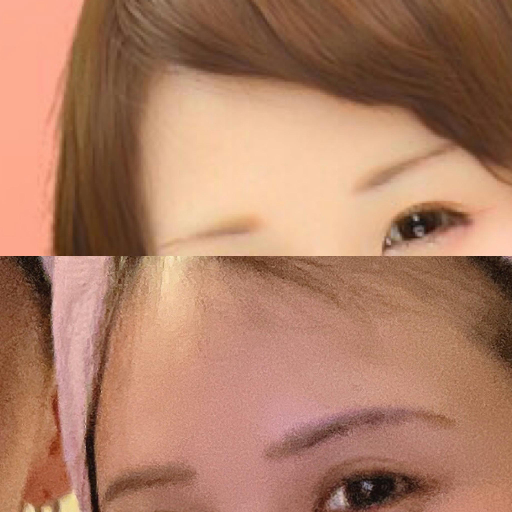 トウキョウテンセイクリニック(Tokyo Tensei Clinic)で眉アートメイクを受けたさゆぴさんの写真