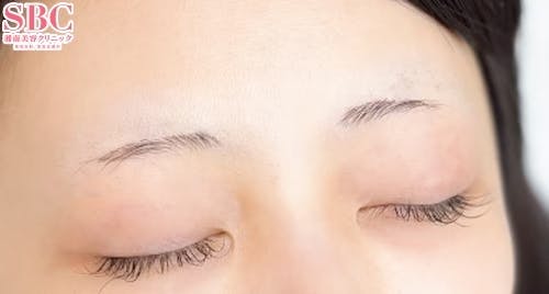 【女性・眉】アートメイク(眉毛)_before