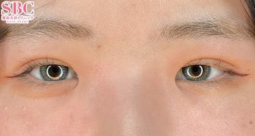 【10代女性・目元】クイックコスメティーク・ダブルNeo_aftar