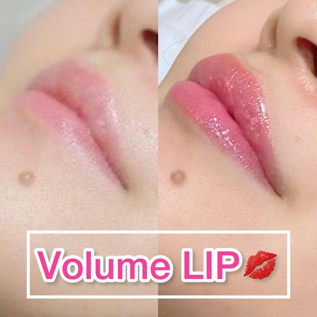 フェミークリニック 池袋院_before_aftar