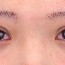 【20代女性・目元】クイックコスメティーク・トリプルNeo_0day