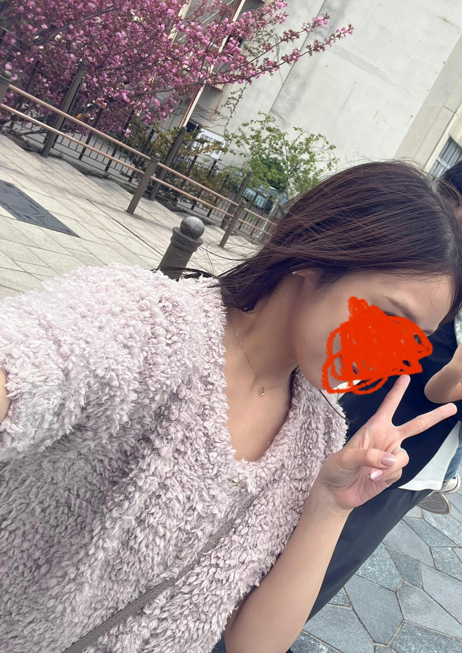 モーブビューティークリニック札幌大通(Mauve Beauty Clinic 札幌大通)でヒアルロン酸 頬コケを受けたelleriさんの写真