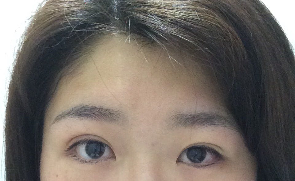 湘南美容クリニック 渋谷院でを受けたまろにーさんの写真