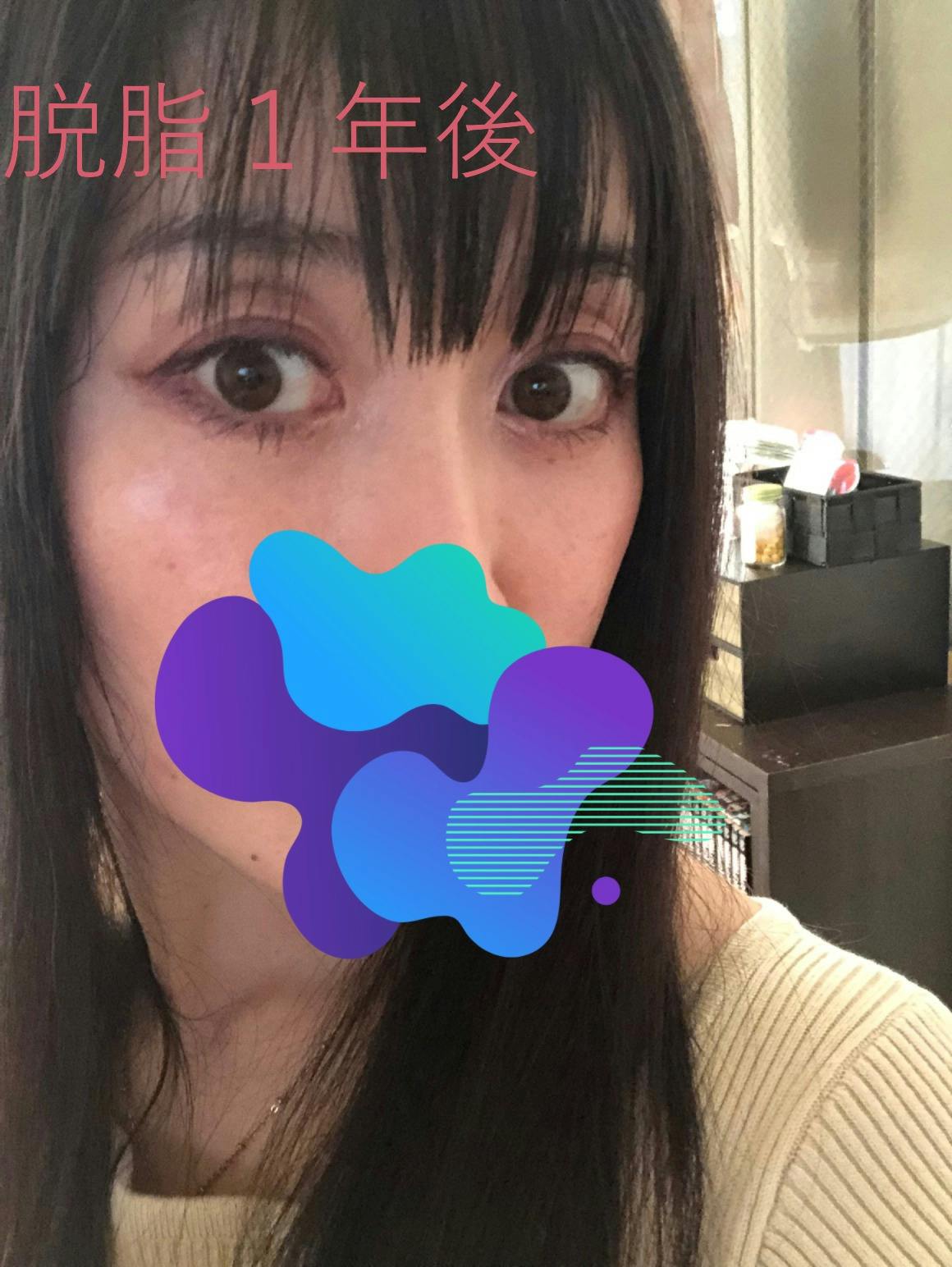 品川美容外科大宮院でを受けたmakkyさんの写真