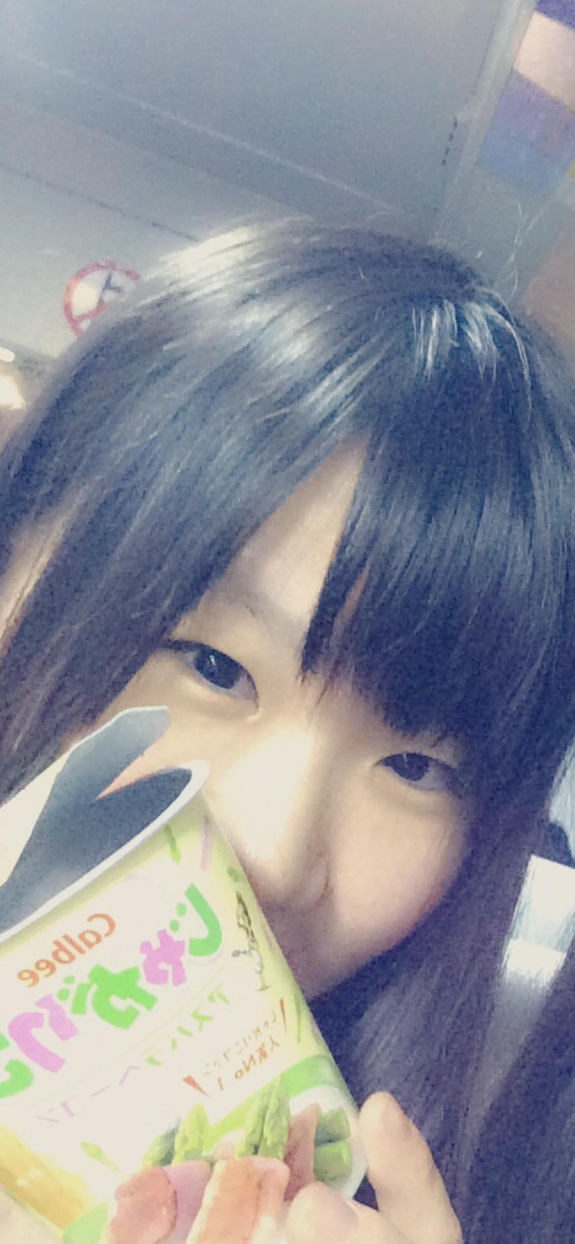 水の森美容クリニック 名古屋院で二重切開を受けたみかさんの写真