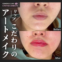 【女性・唇】リップアートメイク_before_aftar