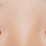 【女性・目元】クイックコスメティーク・ダブルNeo_before