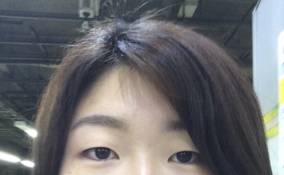 湘南美容クリニック 渋谷院でを受けたまろにーさんの写真
