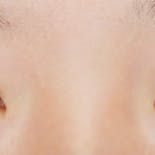 【女性・目元】クイックコスメティーク・ダブルNeo_justbefore