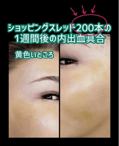 【女性・顔】ショッピングスレッド_before_aftar