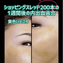 【女性・顔】ショッピングスレッド_before_aftar