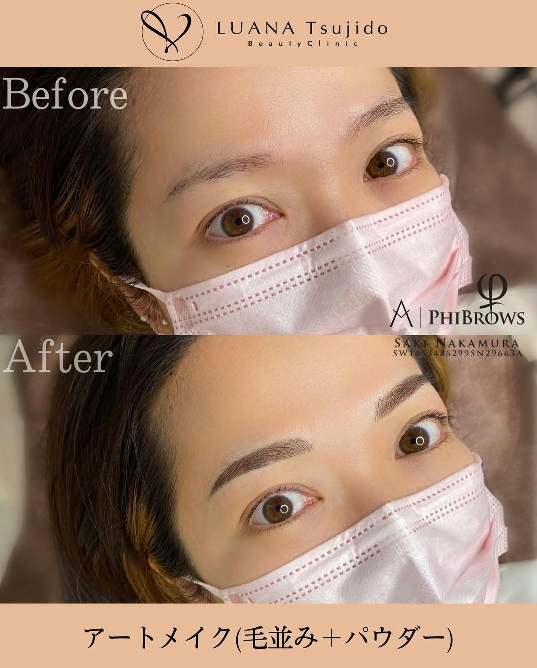 【女性・眉毛】眉アートメイク_before_aftar