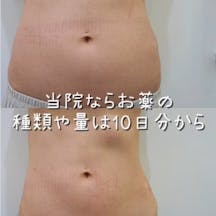 【女性・腹部】リベルサス・カナグル・サノレックス_before_aftar