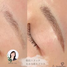 【女性・眉】アートメイク_before_aftar