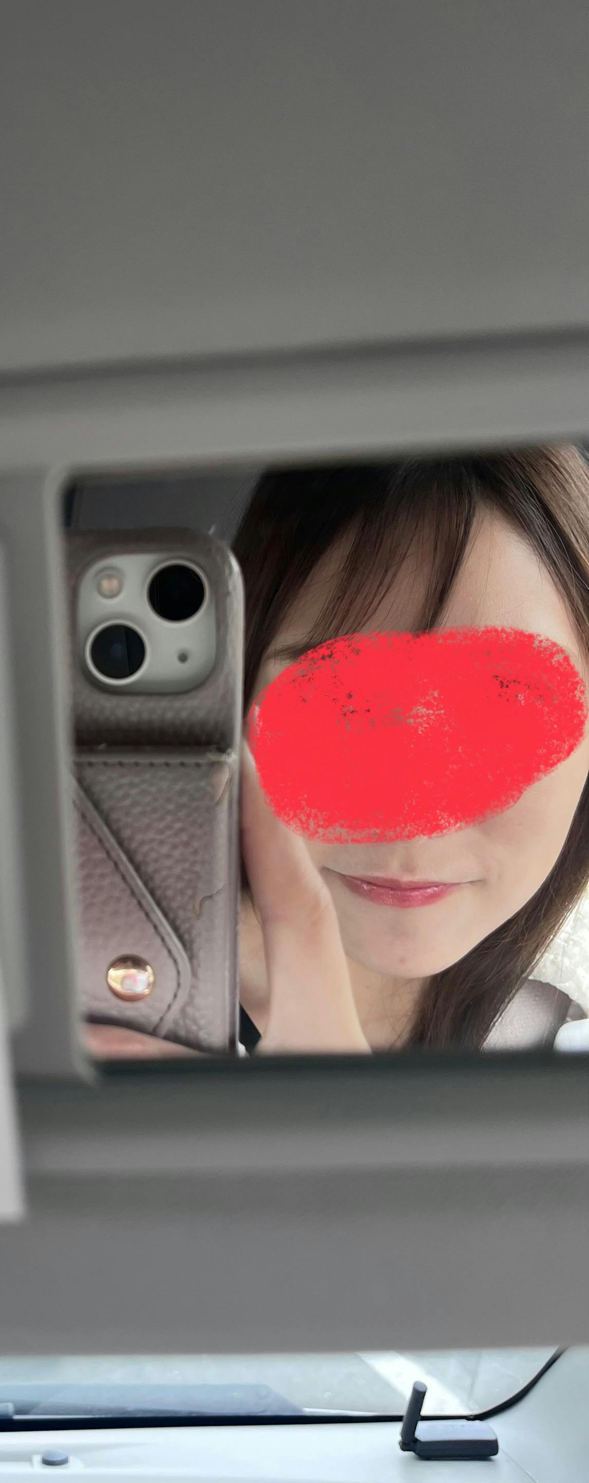 モーブビューティークリニック札幌大通(Mauve Beauty Clinic 札幌大通)で水光注射を受けたelleriさんの写真