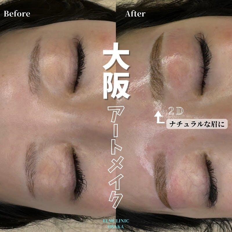 【女性・眉】アートメイク眉毛_before_aftar