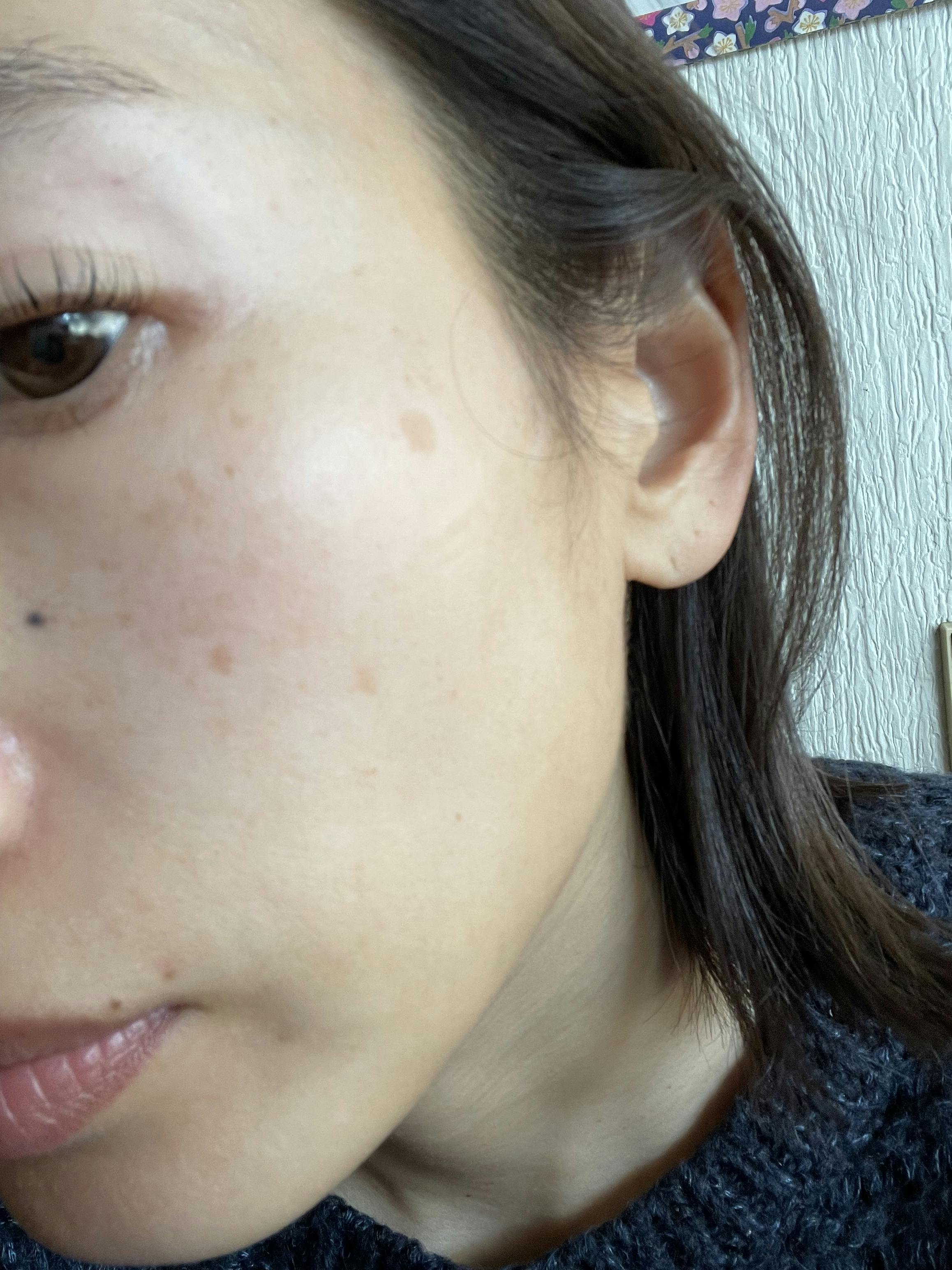 湘南美容クリニック 藤沢院でを受けたKazuminさんの写真