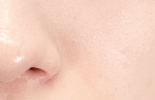 ネビュラクリニック 広島院でを受けたてぃさんの写真