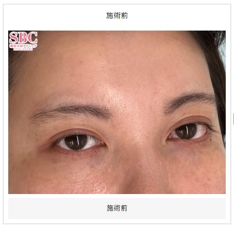 【女性・眉】mocci眉アートメイク（2Dパウダー）_before