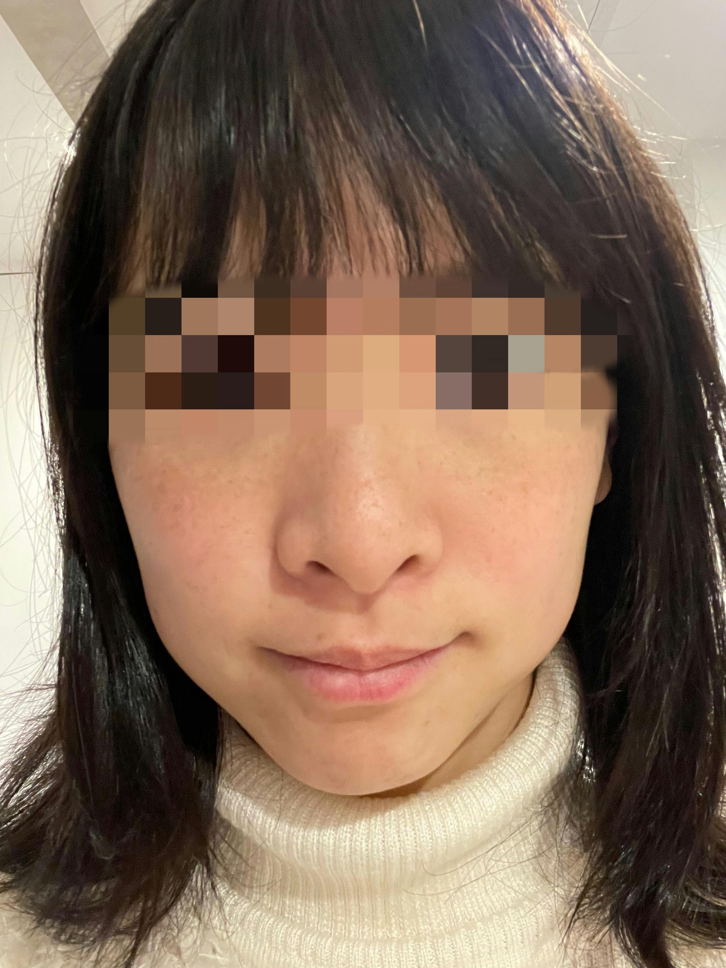 よつば会クリニック 栄・矢場町院でを受けたぽんさんの写真