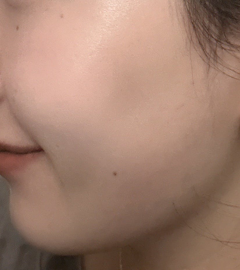 ベンスクリニック新宿でを受けたseikaさんの写真