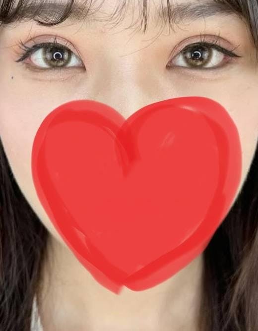 湘南美容クリニック 横浜院で目元整形：白目整形＋クマ取り再生術＋二重術クイックコスメティークNeoを受けたピアノさんの写真