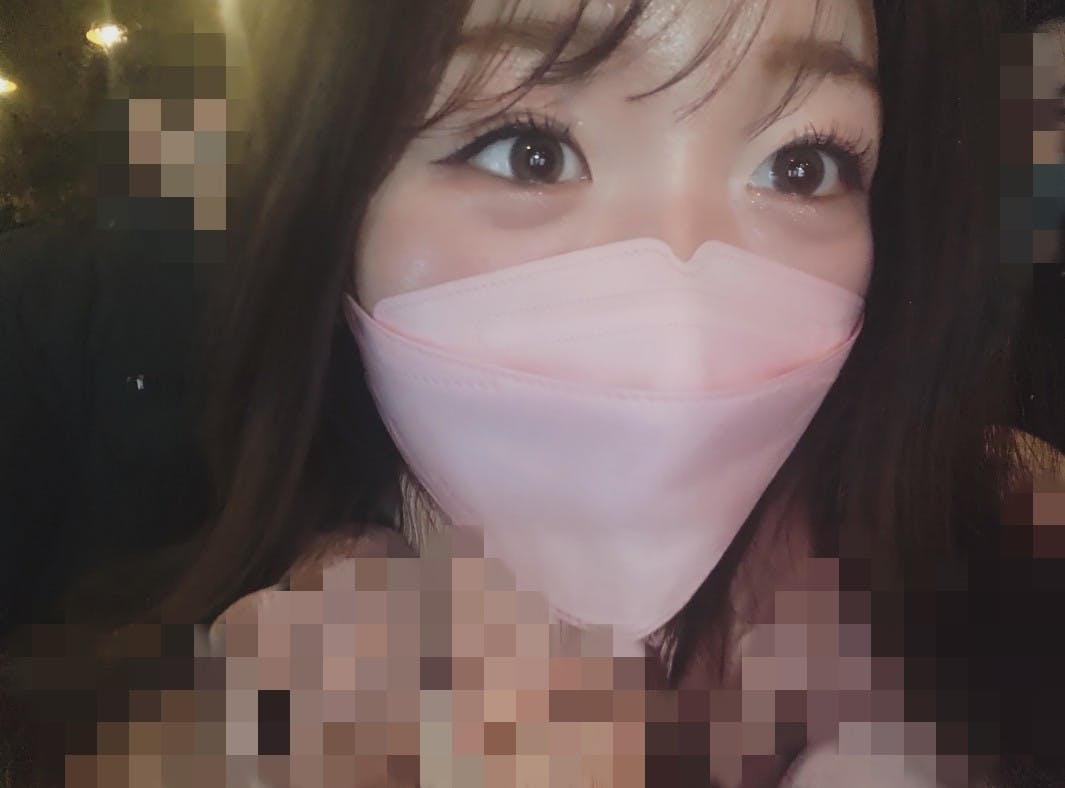 湘南美容クリニック 川崎院でを受けたhanaさんの写真