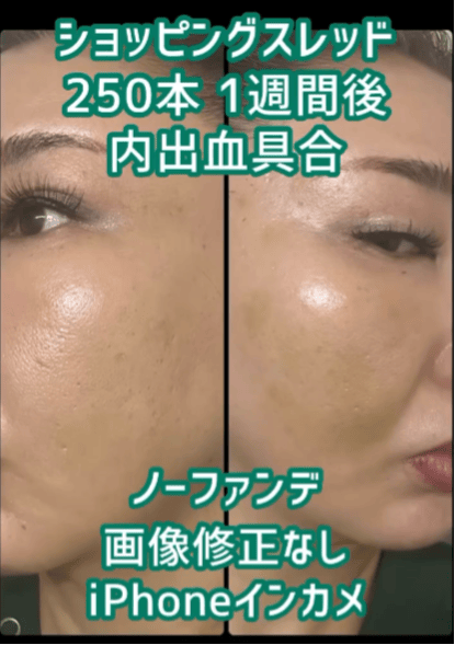 【女性・肌】ショッピングスレッド_before_aftar