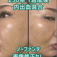 【女性・肌】ショッピングスレッド_before_aftar