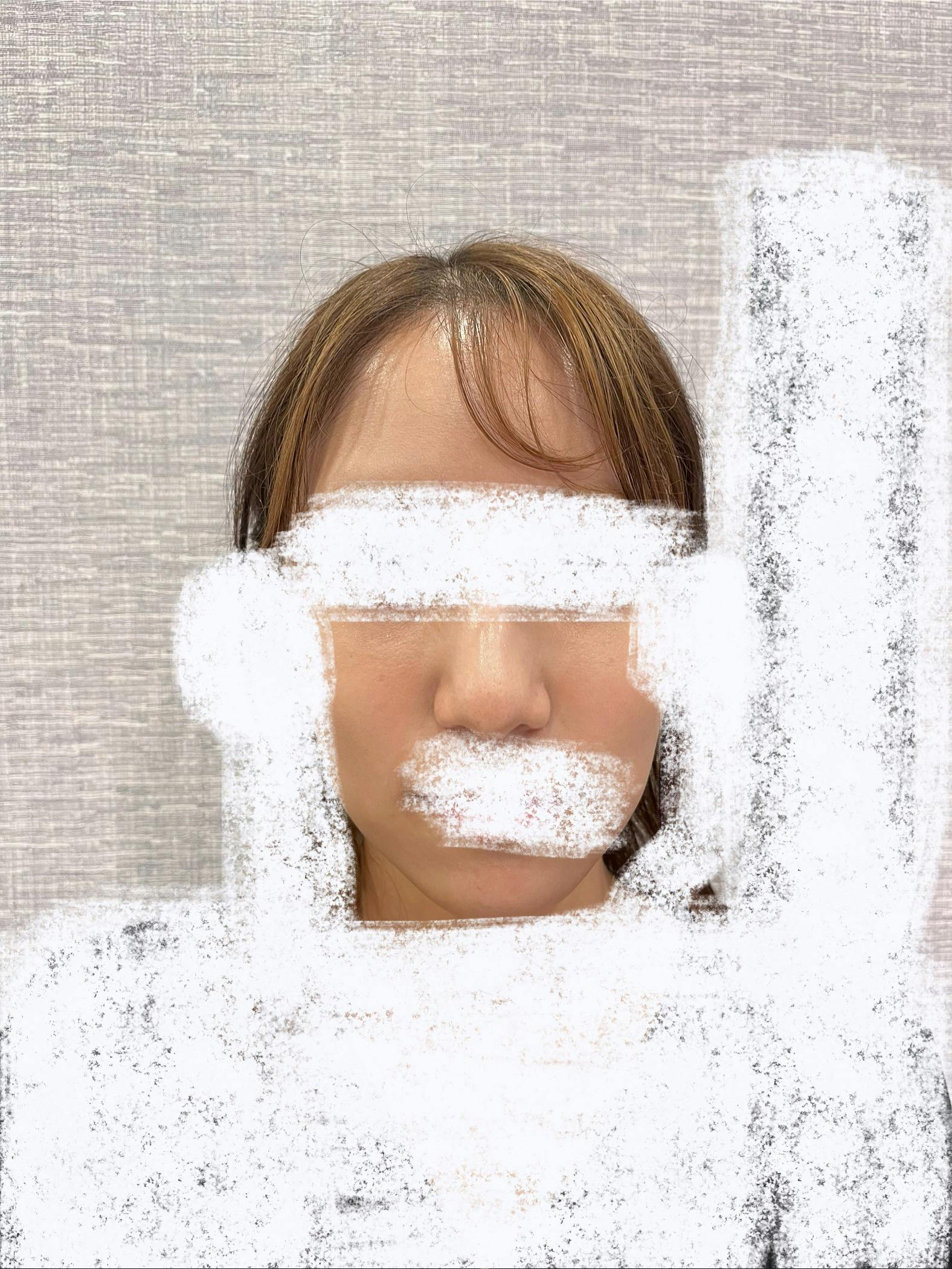 モーブビューティークリニック札幌大通(Mauve Beauty Clinic 札幌大通)でハイドラフェイシャルを受けたelleriさんの写真