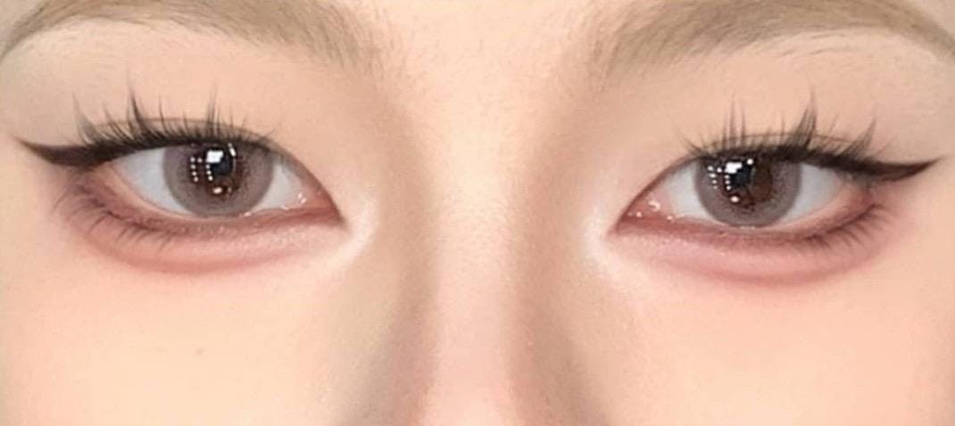 銀座TAクリニックで二重切開：不明を受けたそーちゃんさんの写真
