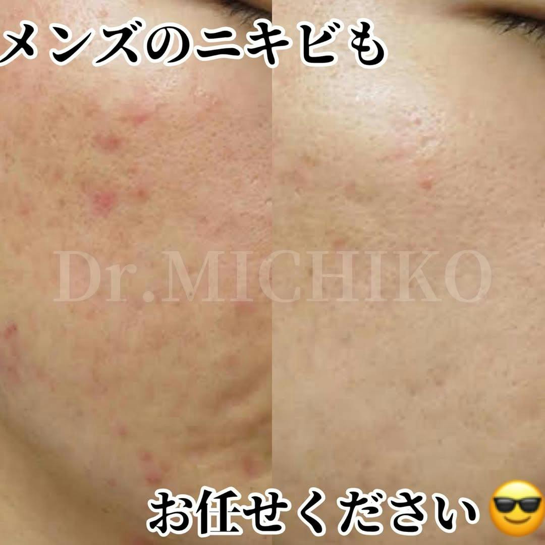 フェミークリニック 池袋院_before_aftar