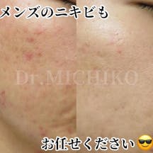 フェミークリニック 池袋院_before_aftar