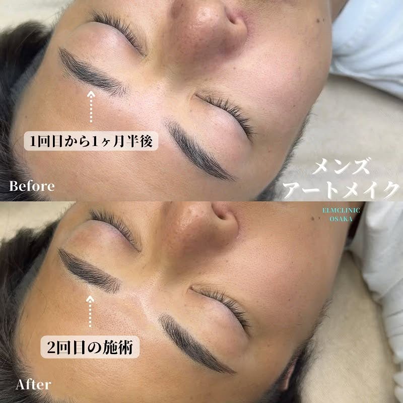 【男性・眉】アートメイク_before_aftar