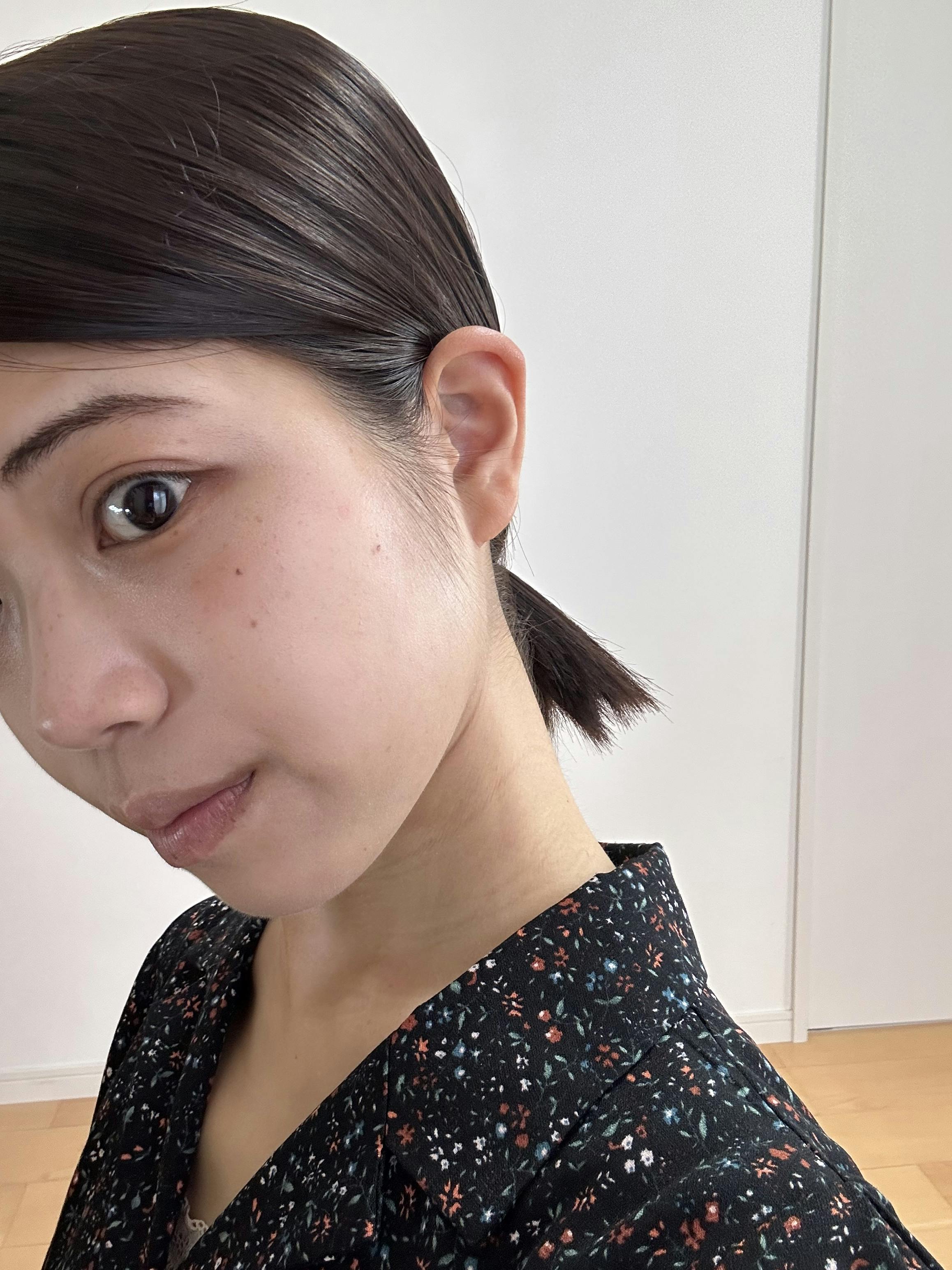 湘南美容クリニック 大阪心斎橋院_フォトダブル